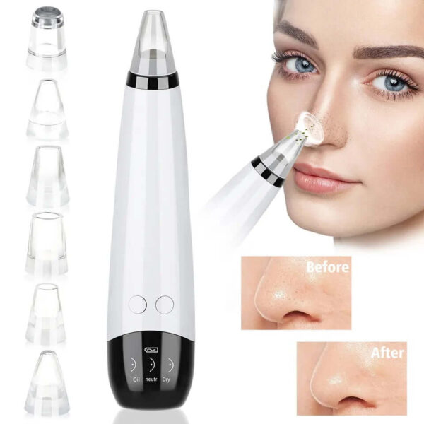 Black Heads Remover Vacuum Pore Facial Cleaner - Image 3